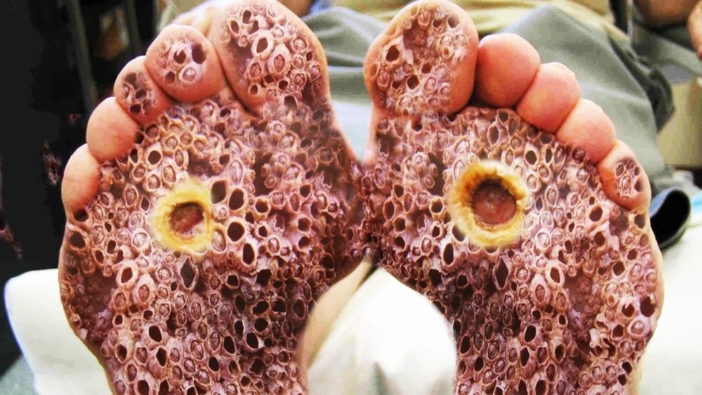 cheesy feet only real with holes - #162922485 added by savageoro at Creepy  Plants
