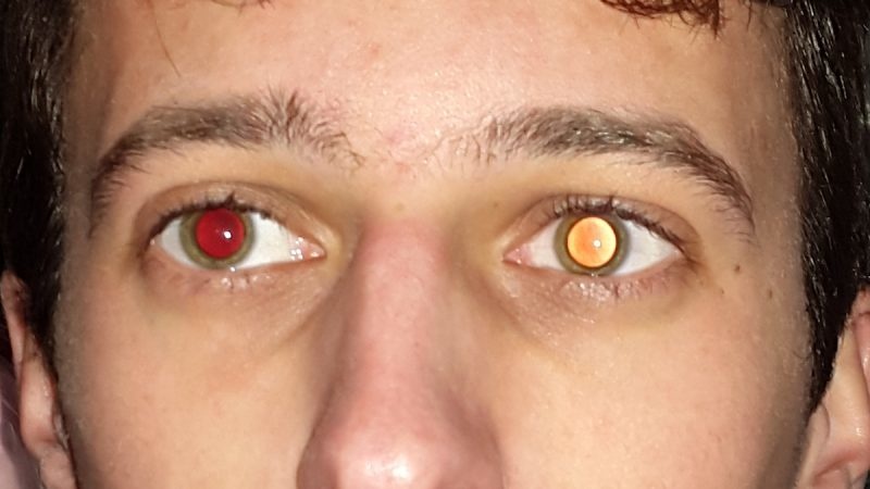 Красный глаз на фото